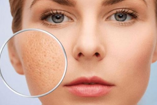 Serum đặc trị mụn giúp giảm vết thâm và thu nhỏ lỗ chân lông trên da
